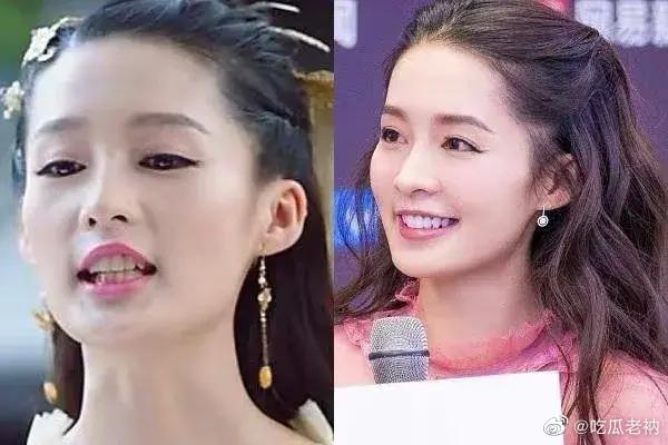 明星整牙，从改变牙齿迈向自信人生之路