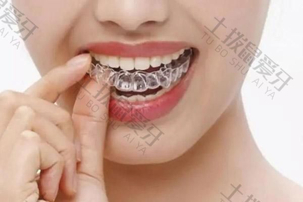 矫正牙套价格详解，了解矫正牙套的价格范围及因素
