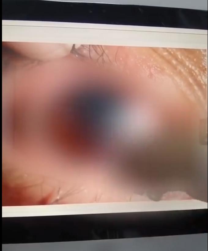 土右爆炸事件最新进展揭秘，跟进事件进展与应对技能学习的重要性