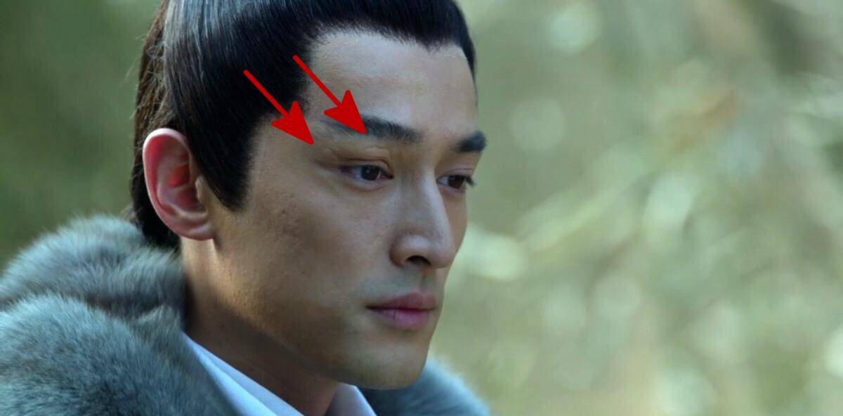 明星脸上疤痕，友情与爱的温馨篇章
