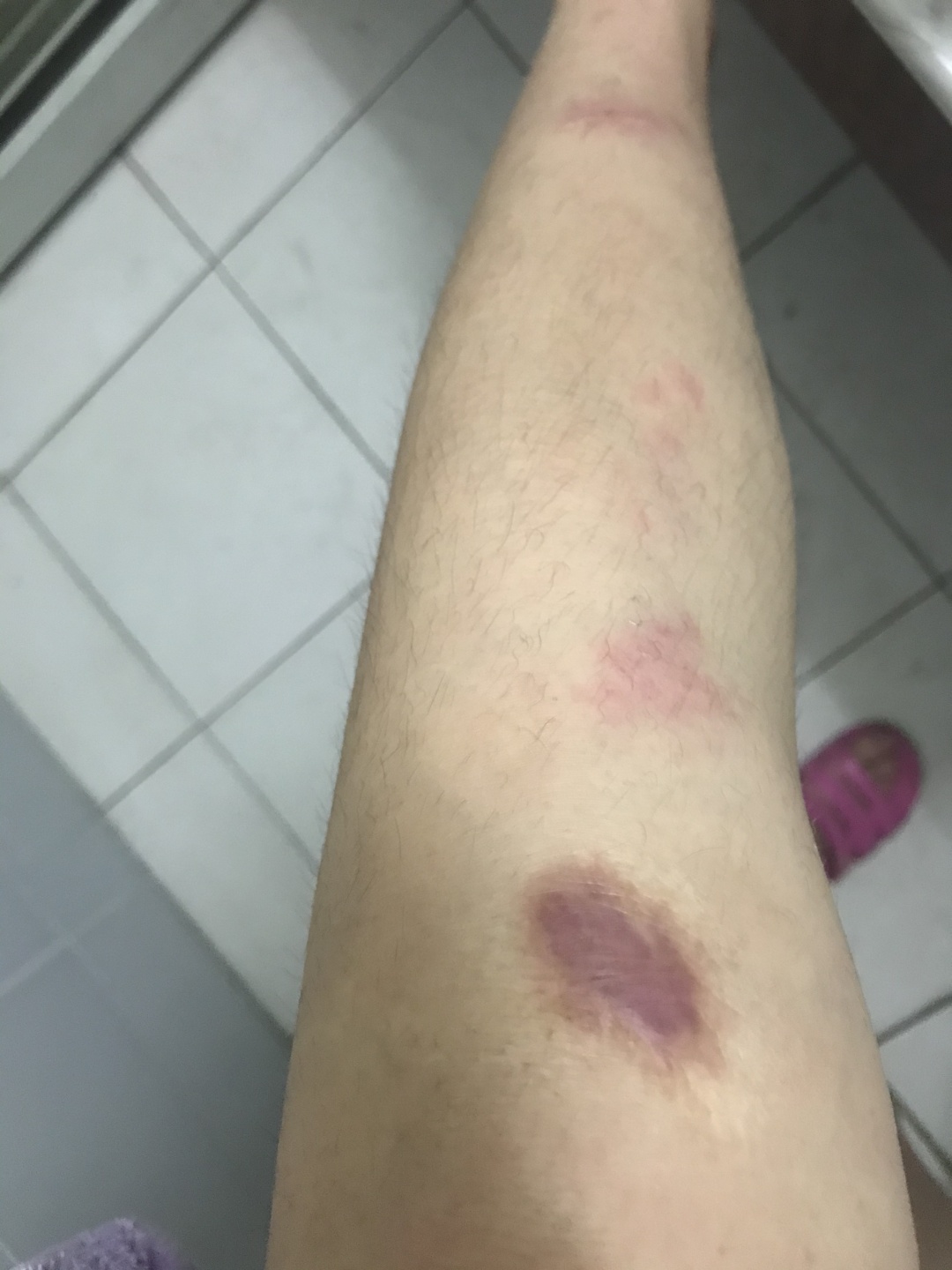 溅起伤口的美最新章节励志启示，勇敢面对生活的疤痕与成长之路。