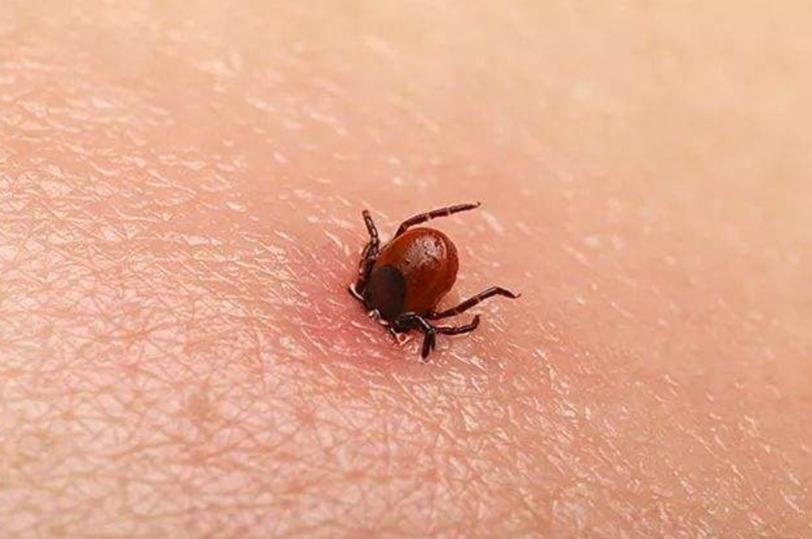 病毒传播最新动态，详细步骤指南与防范建议