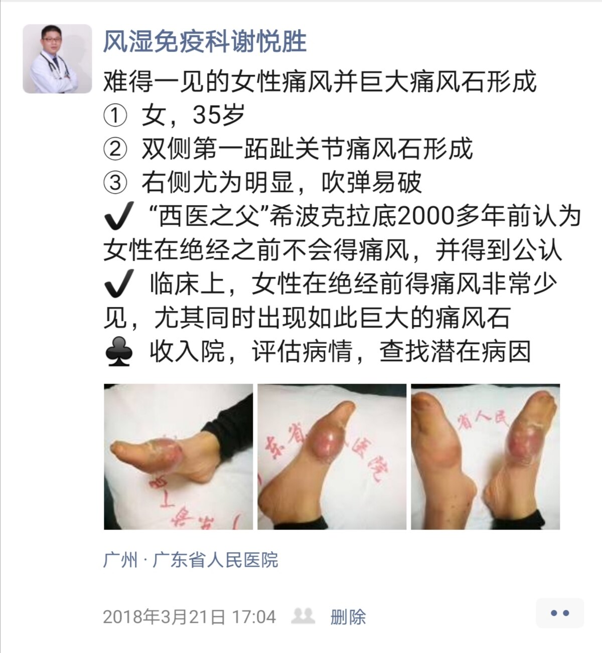 科技突破助力攻克痛风，智能产品重塑生活新篇章